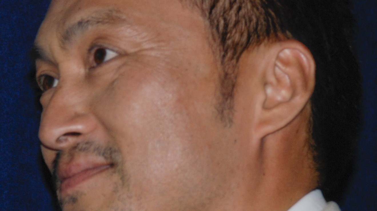 Celebrities With Hepatitis Hep