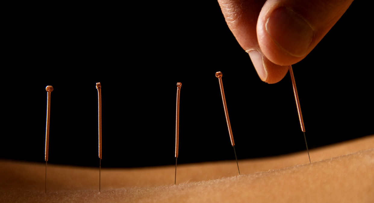 Acupuncture Improves Joint Pain in Breast Cancer Patients Taking