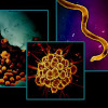 Electron micrograph imagery of bacteria that cause three sexually transmitted infections: chlamydia (left), gonorrhea (center), and syphilis (right).