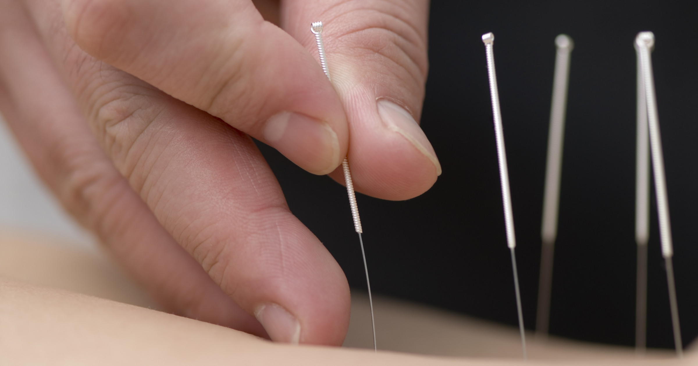 Acupuncture in Cancer Care