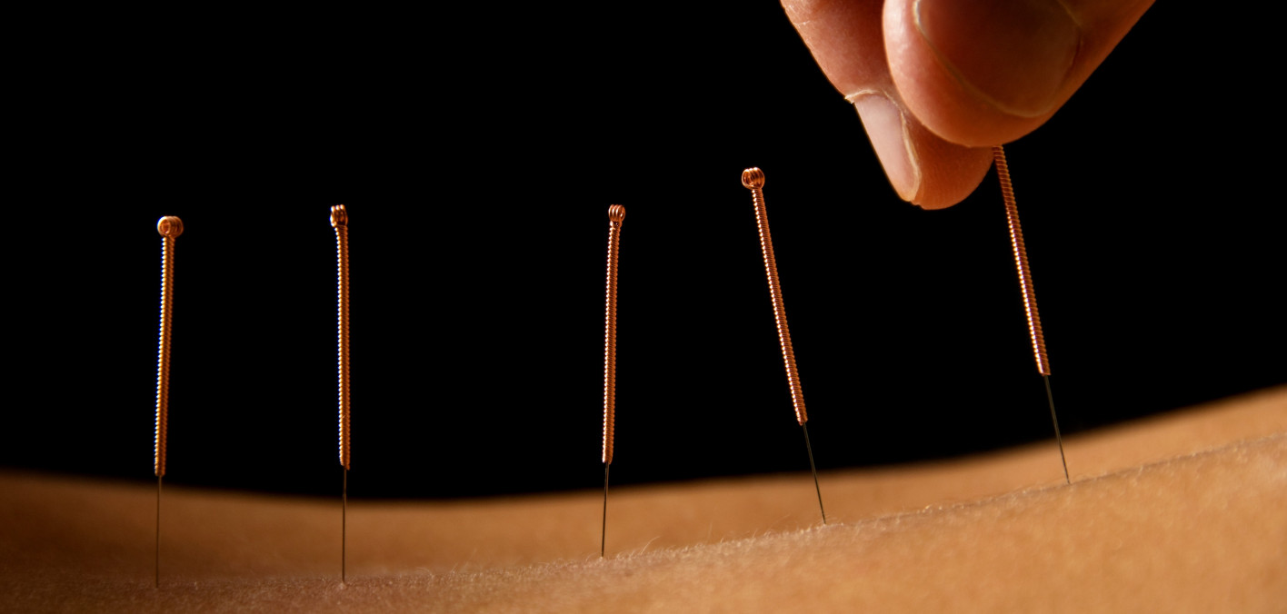 Acupuncture May Improve Breast Cancer-Related Cognitive Difficulties