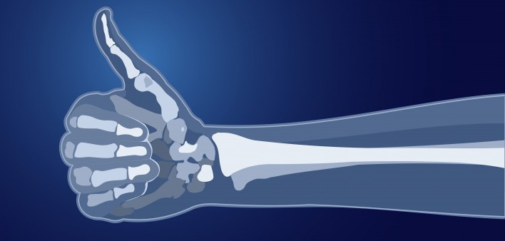  bones skeleton x-ray