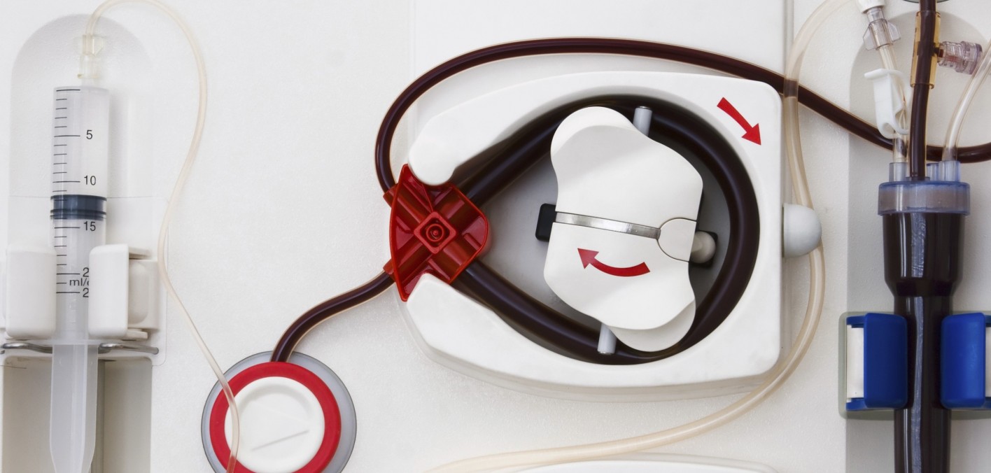 New Liver Dialysis Device to Be Tested in Europe Hep