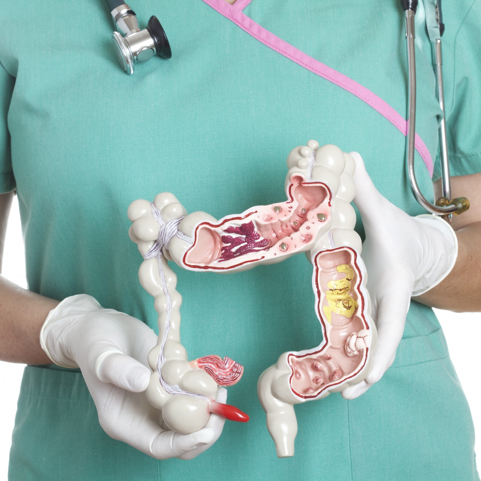 Cancer Health Basics: Colon Cancer - Cancer Health