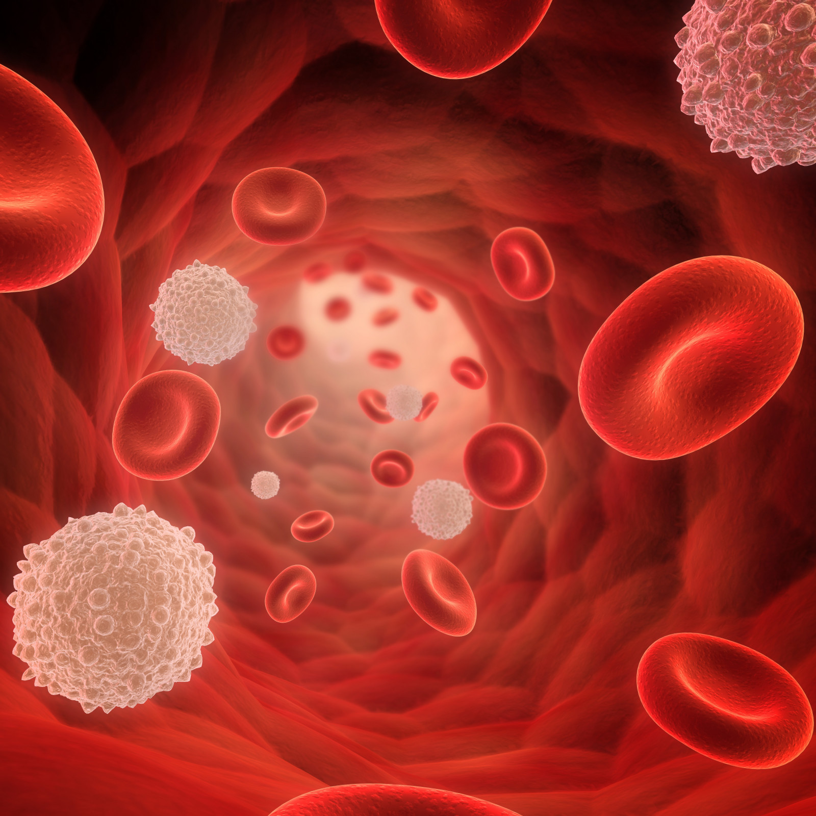 Агранулоцитоз нейтропения. Агранулоцитоз нейтропения. Миелоцитарный агранулоцитоз. Агранулоцитоз нейтропения. Агранулоцитоз нейтропения.