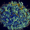 Microscopic image of an HIV-infected T cell